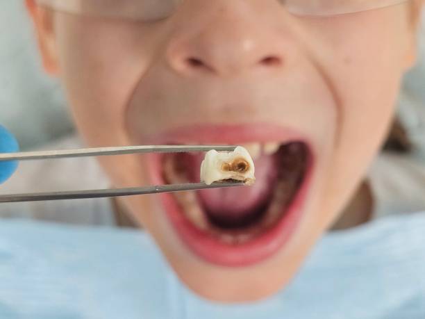 Best Walk-In Emergency Dental Services in Nashotah, WI